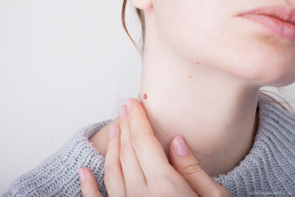 Patogeneze HPV